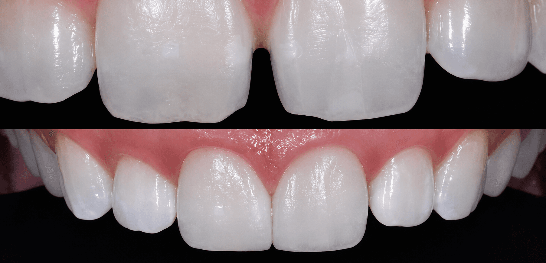 Cosmetic fillings